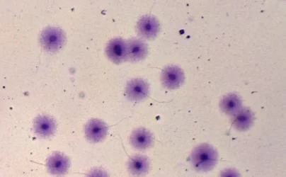 19.Fragmentación de espermatozoides (1)
