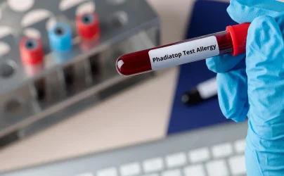 Phadiatop Test Allergy