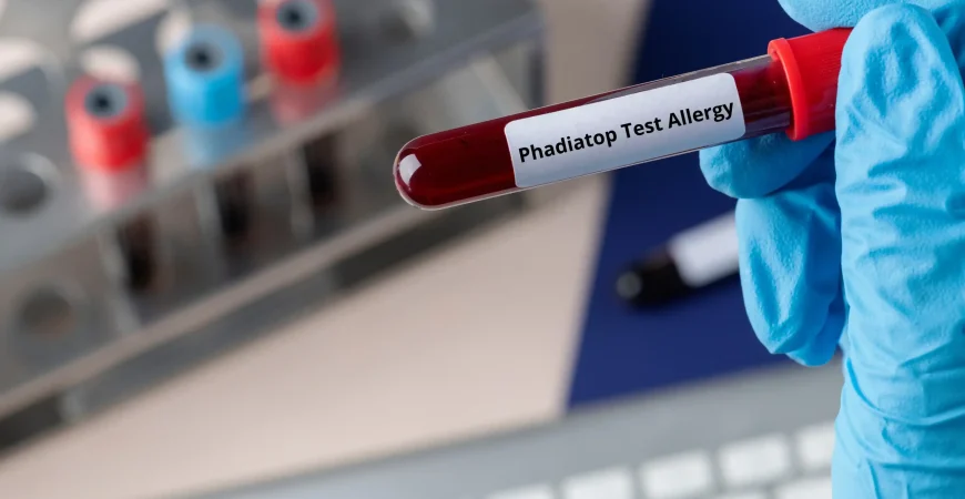Phadiatop Test Allergy