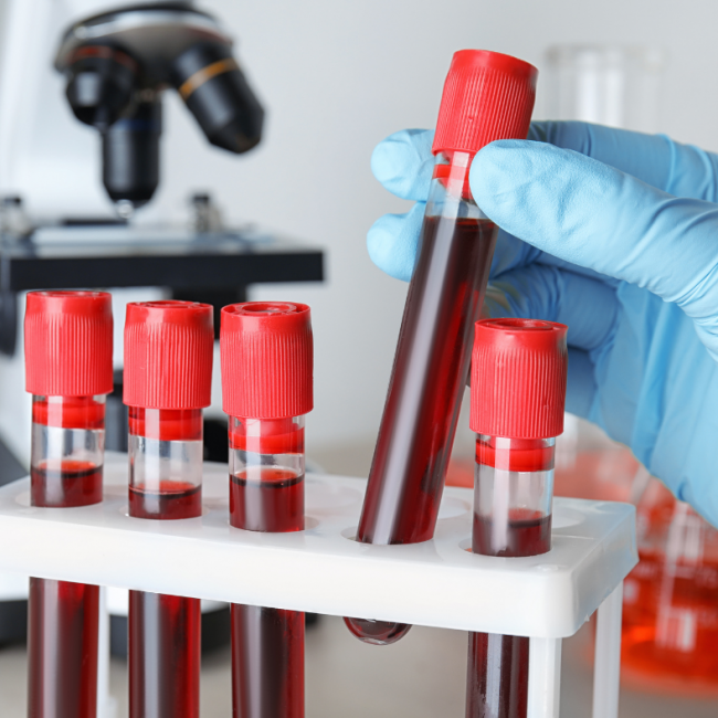 Muestras de sangre